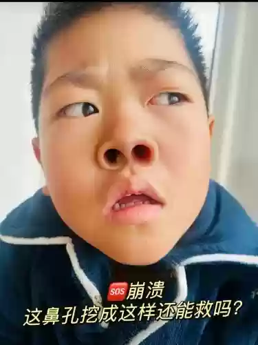 大鼻孔阵容插图1